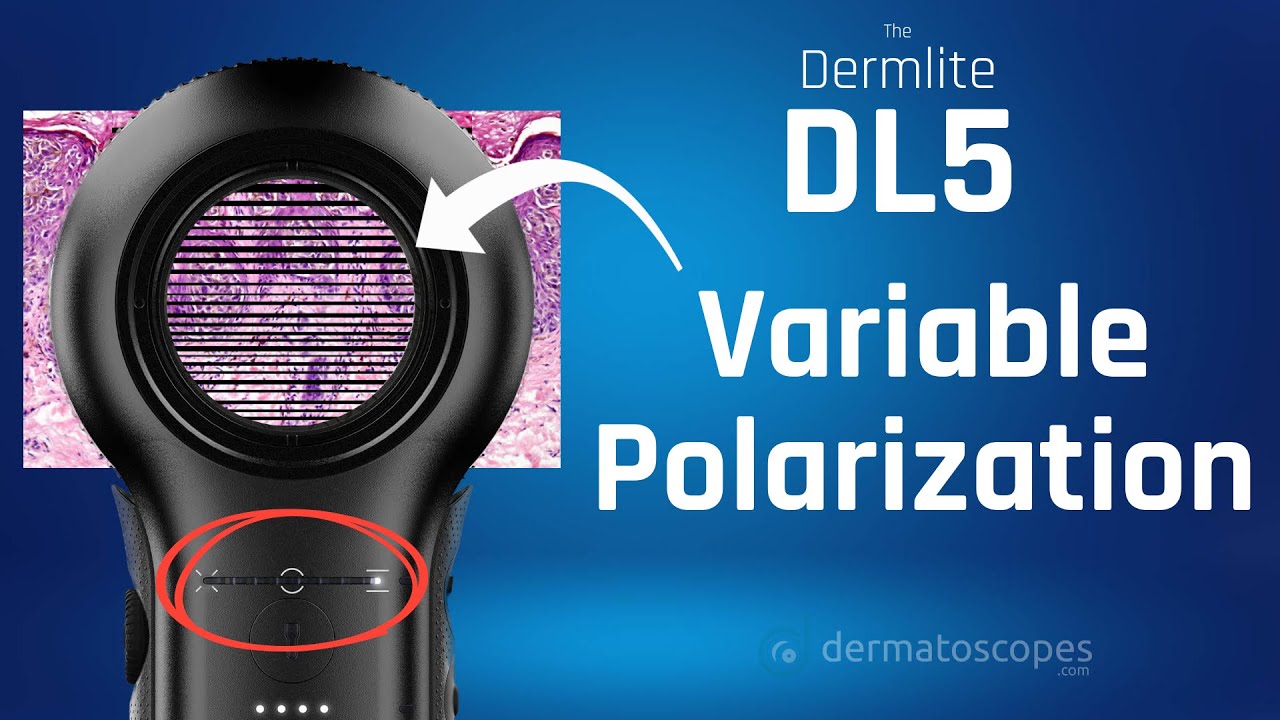 Dermlite DL5 - What Is Variable Polarization?
