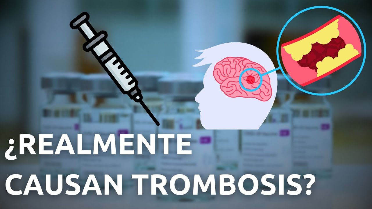 ¿TROMBOSIS por VACUNA COVID AZ?💉