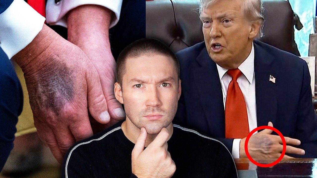 Is Donald Trump Dying?