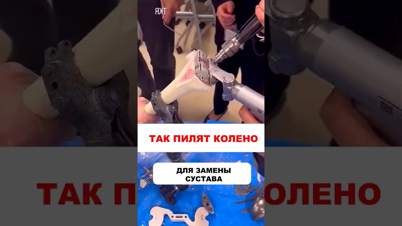 Хотите иметь в своем теле такую штуку?