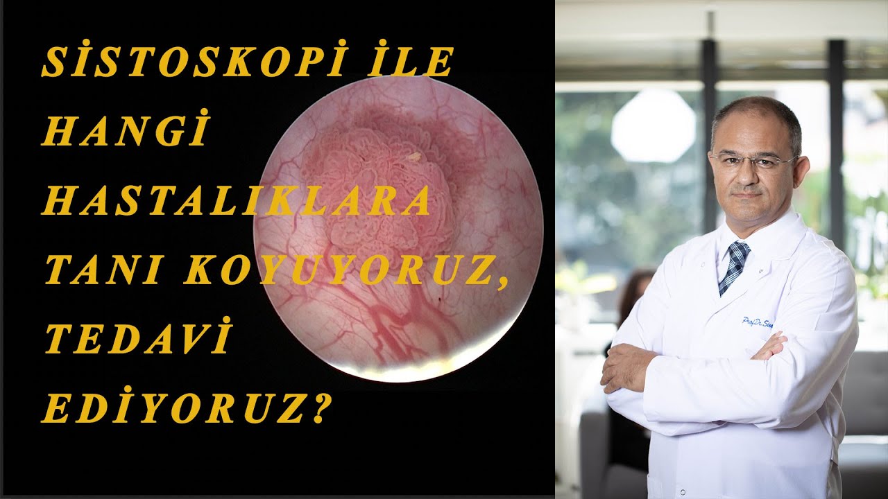 SİSTOSKOPİ, FLEKSİBIL SİSTOSKOPİ NEDİR? NASIL YAPILIR? SİSTOSKOPİ HANGİ DURUMLARDA YAPILMALIDIR?