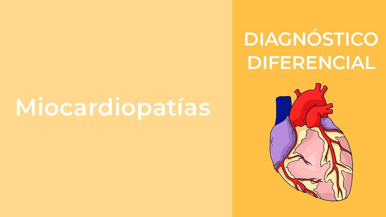 Diagnóstico Diferencial Miocardiopatías