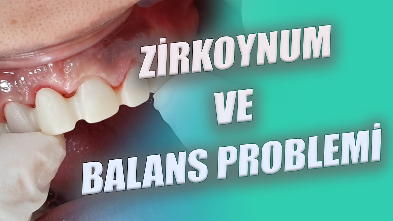 Zirkonyumda Balans Problemi Nasıl Çözülür?