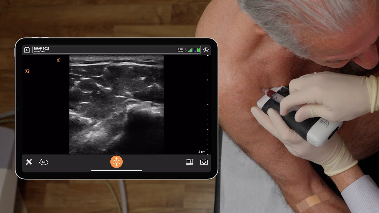 PRP Shoulder Injection
