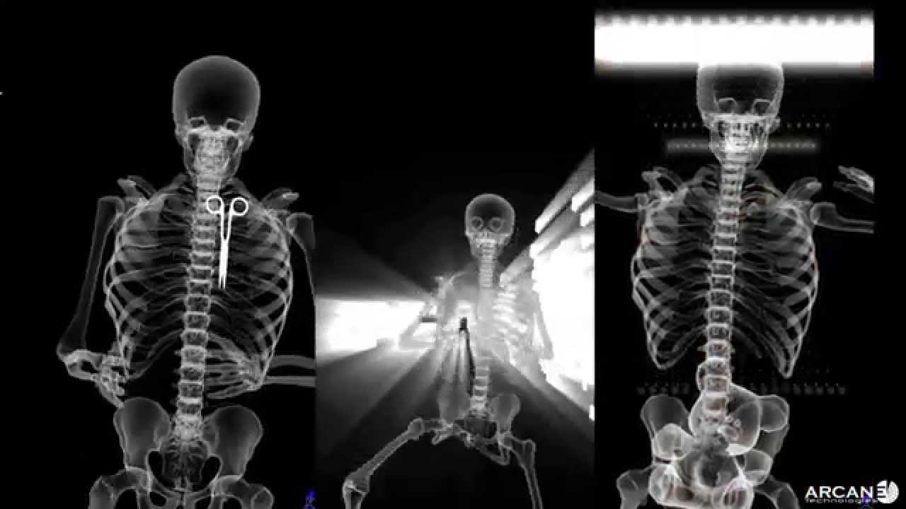 Scanner corporel à rayons X interactif / Interactive X-Ray Body Scanner