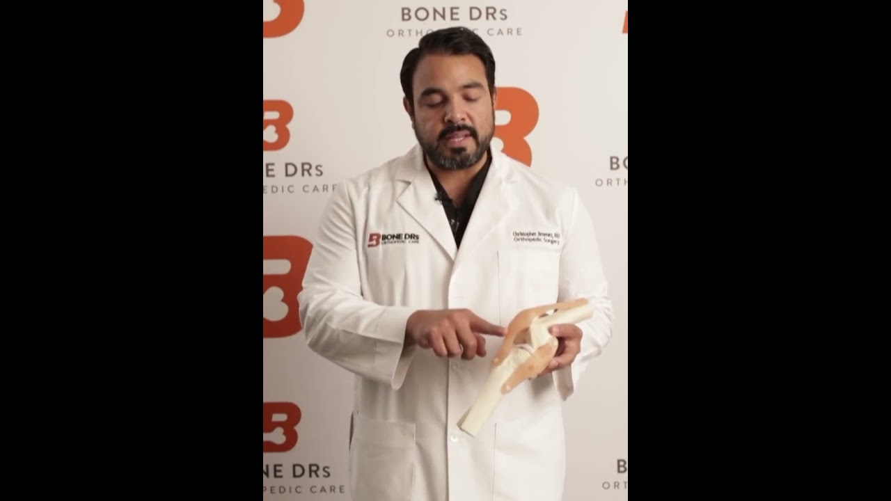 Dr Jimenez Explains Patellar Tendinitis and Patellar Tendon Rupture