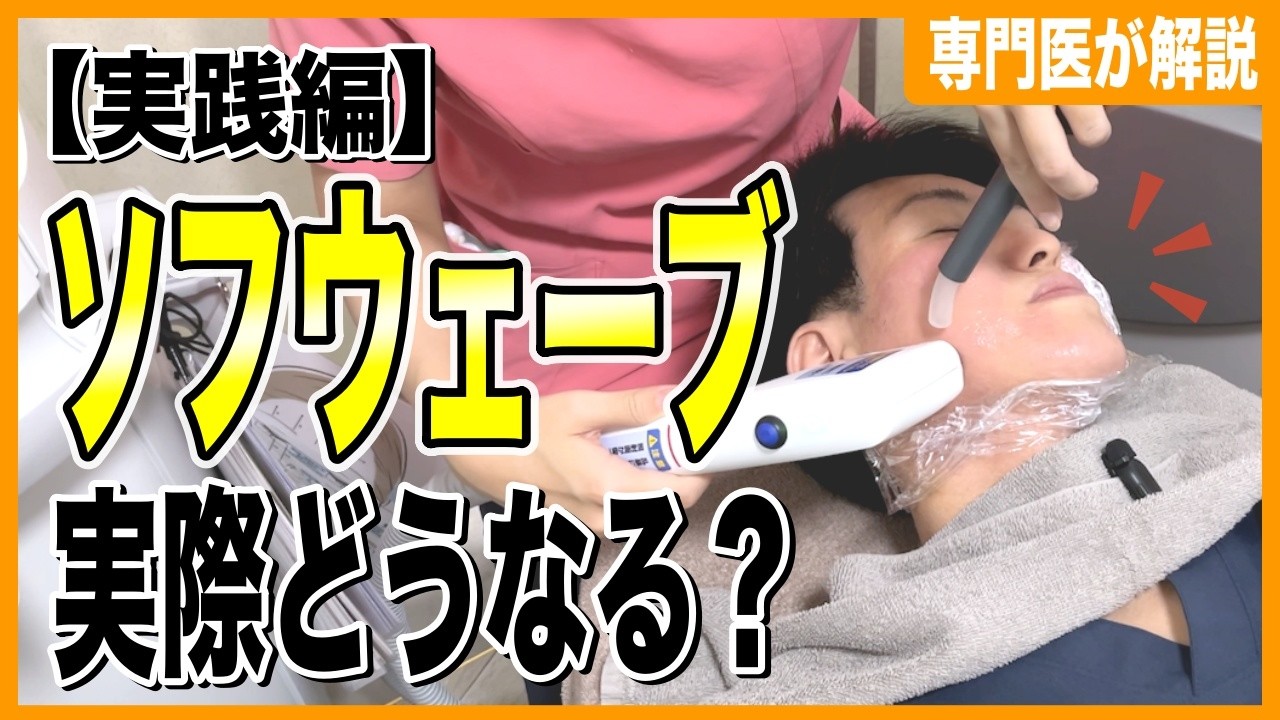 【HIFU(ハイフ)などのたるみ治療とは何が違う？】美容皮膚科医が自ら体験したソフウェーブ施術の実際