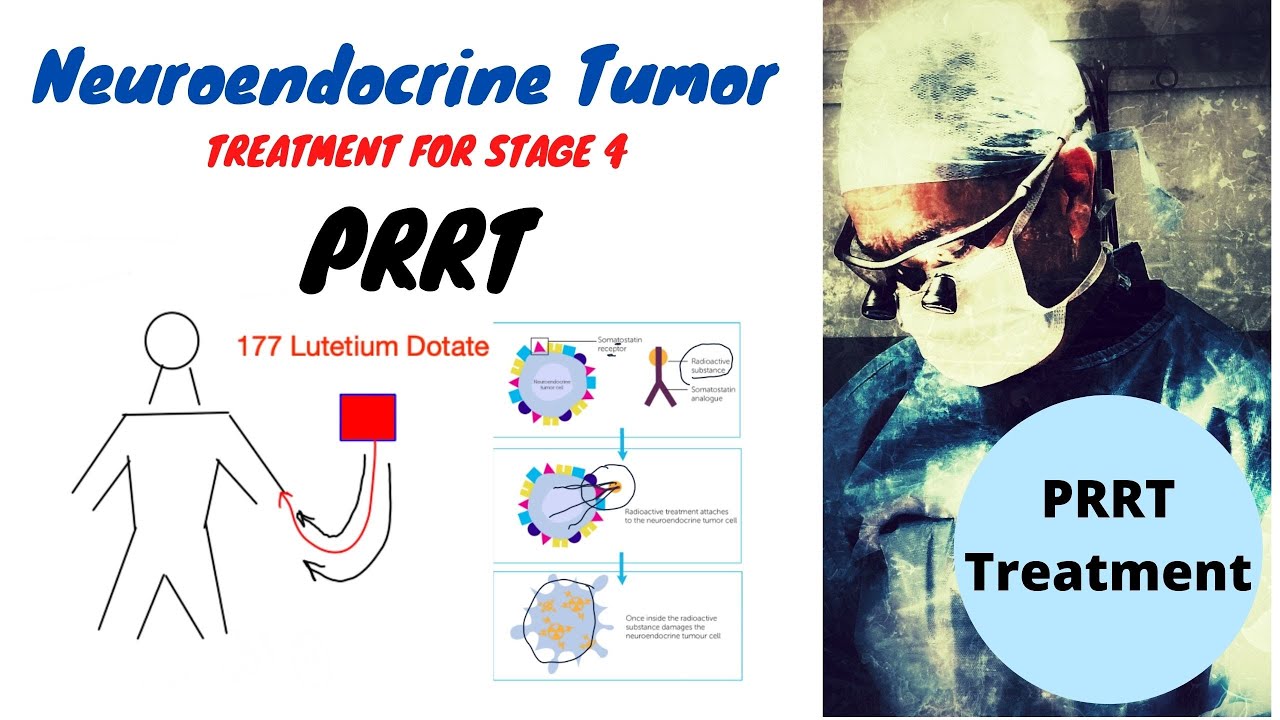 PRRT Treatment Neuroendocrine Tumors