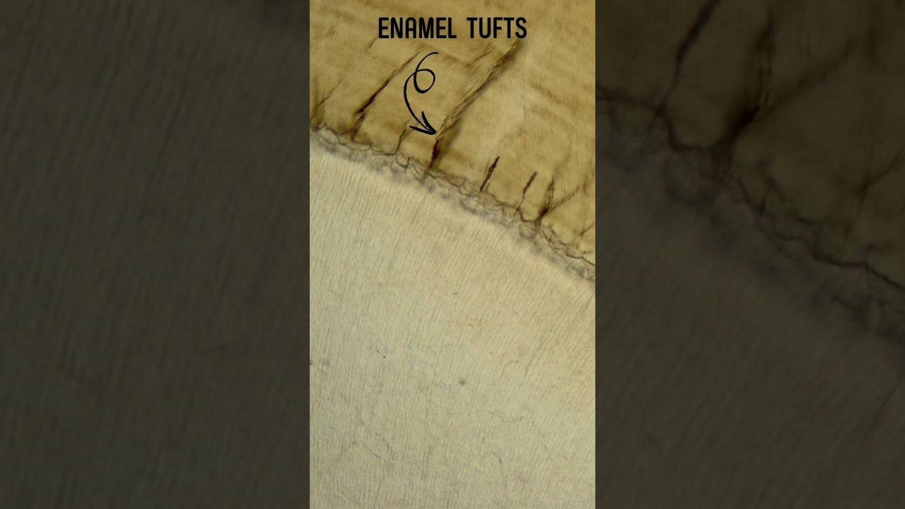 Enamel  Spindle, Enamel Tufts, Enamel Tufts Lamella