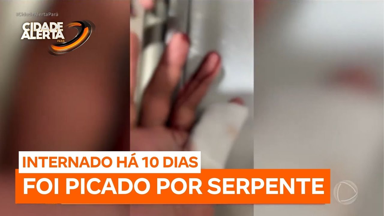 Jovem é picado por jararaca durante trilha em parque de Belém