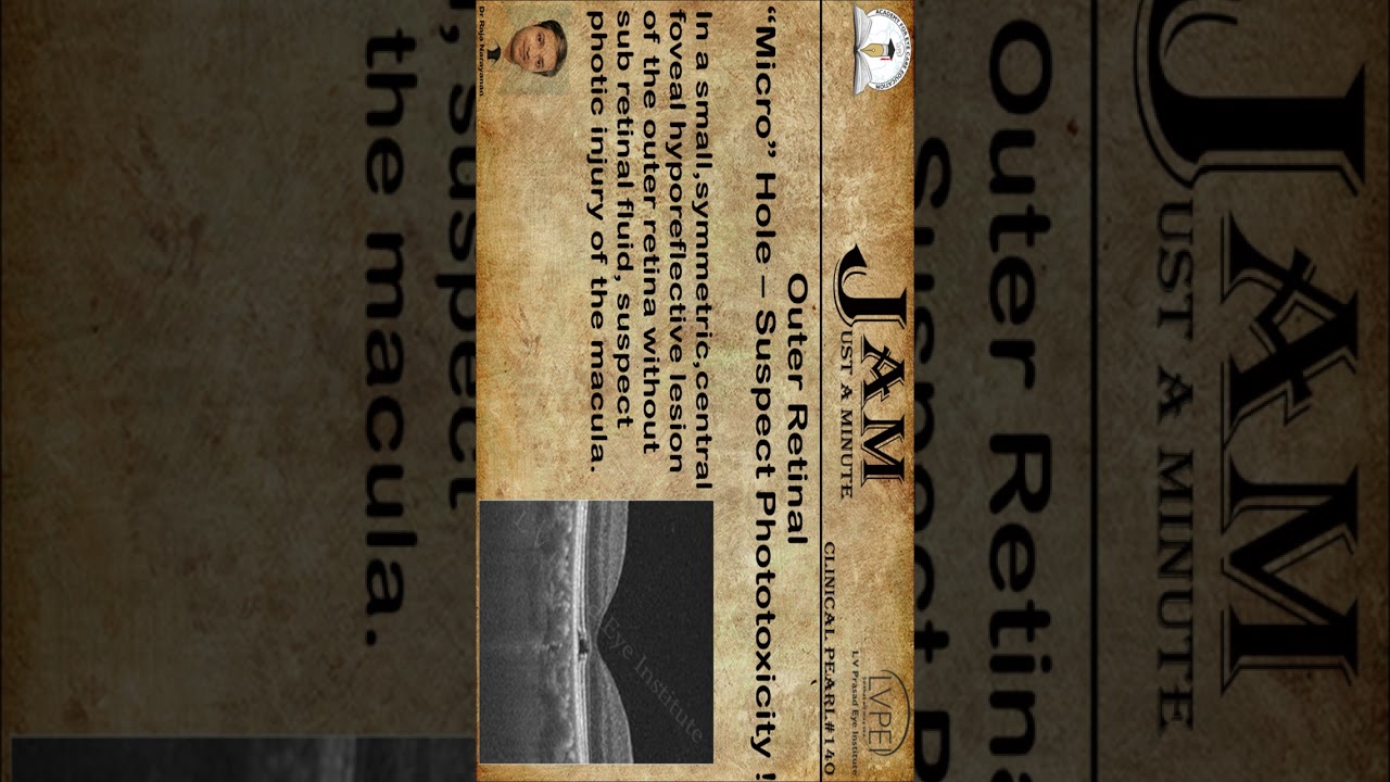 Outer Retinal 