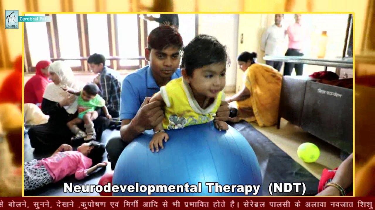 Cerebral Palsy Treatment with Multi-Modal Therapy(Part 1), CP Child Physiotherapy Trishla Foundation