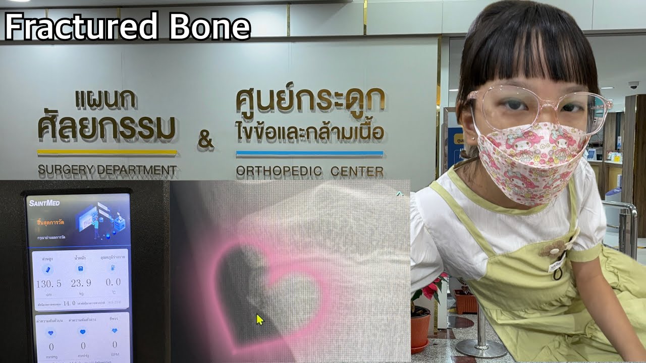 Ep393 Fractured bone กระดูกหัวเข่าแตก มารู้หลังจากที่หกล้มมา 1 เดือนเต็ม