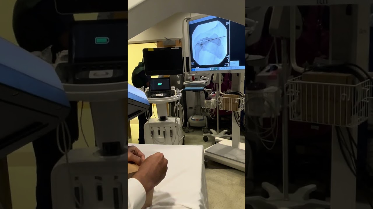 Dr. Elsharkawy shows Curonix Suprascapular Nerve PNS