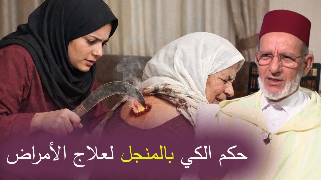 حكم الكي بالمنجل لعلاج الأمراض: بين الطب والشرع