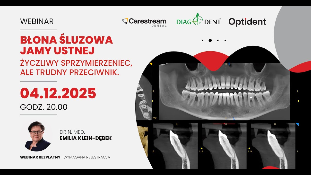 Webinar: Błona śluzowa jamy ustnej. Życzliwy sprzymierzeniec, ale trudny przeciwnik