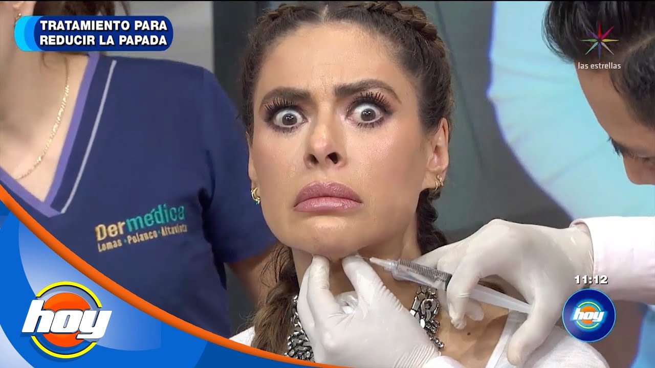 Tratamiento para reducir la papada | Hoy