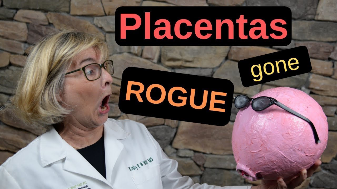 Placentas Gone Rogue Placenta Previa