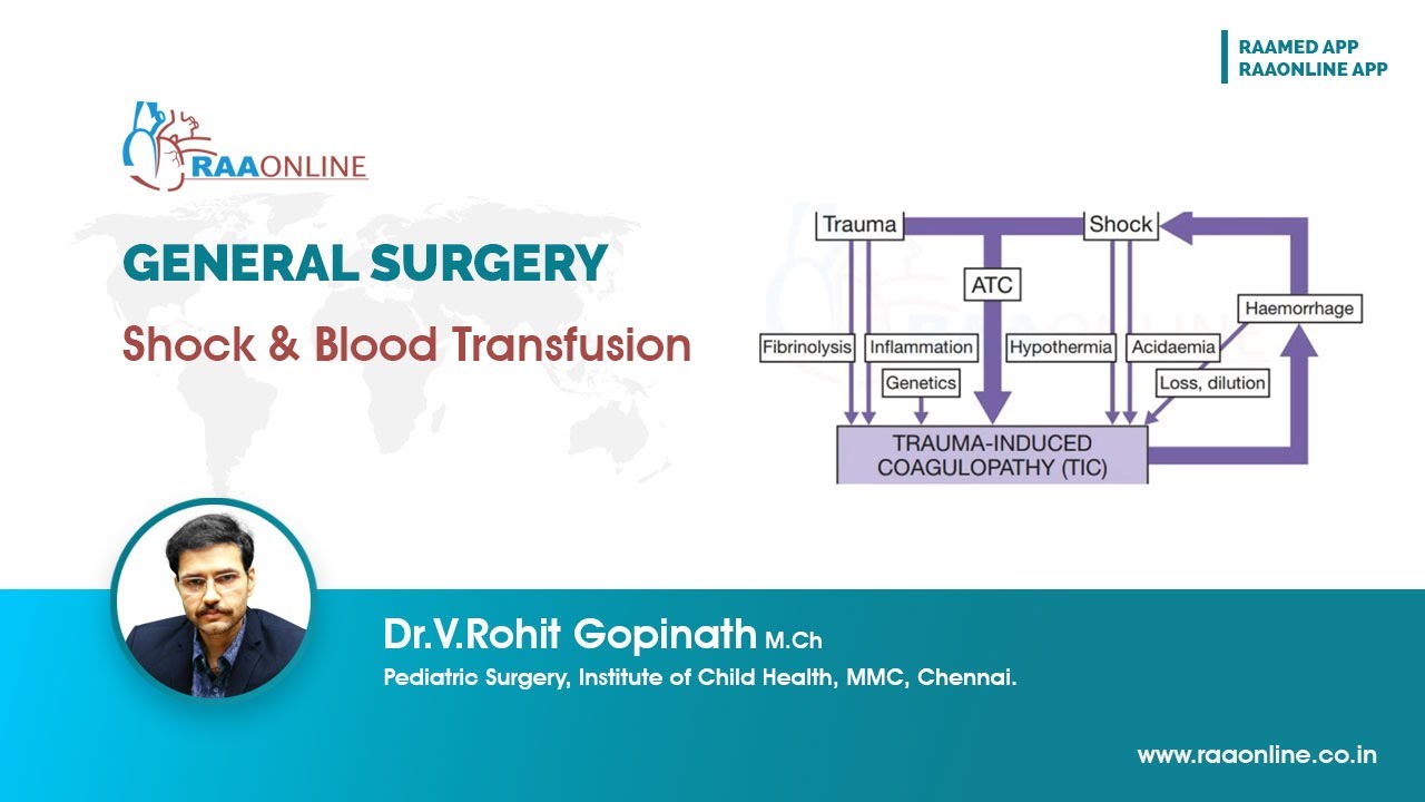 General Surgery | Shock and Blood Transfusion | By Dr.Rohit Gopinath #generalsurgery #transfusion