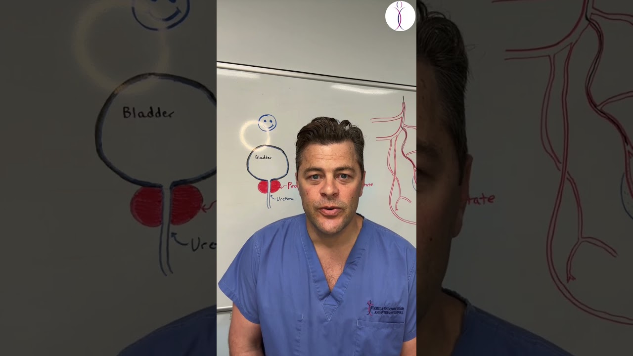 Prostate Artery Embolization for Enlarged Prostate