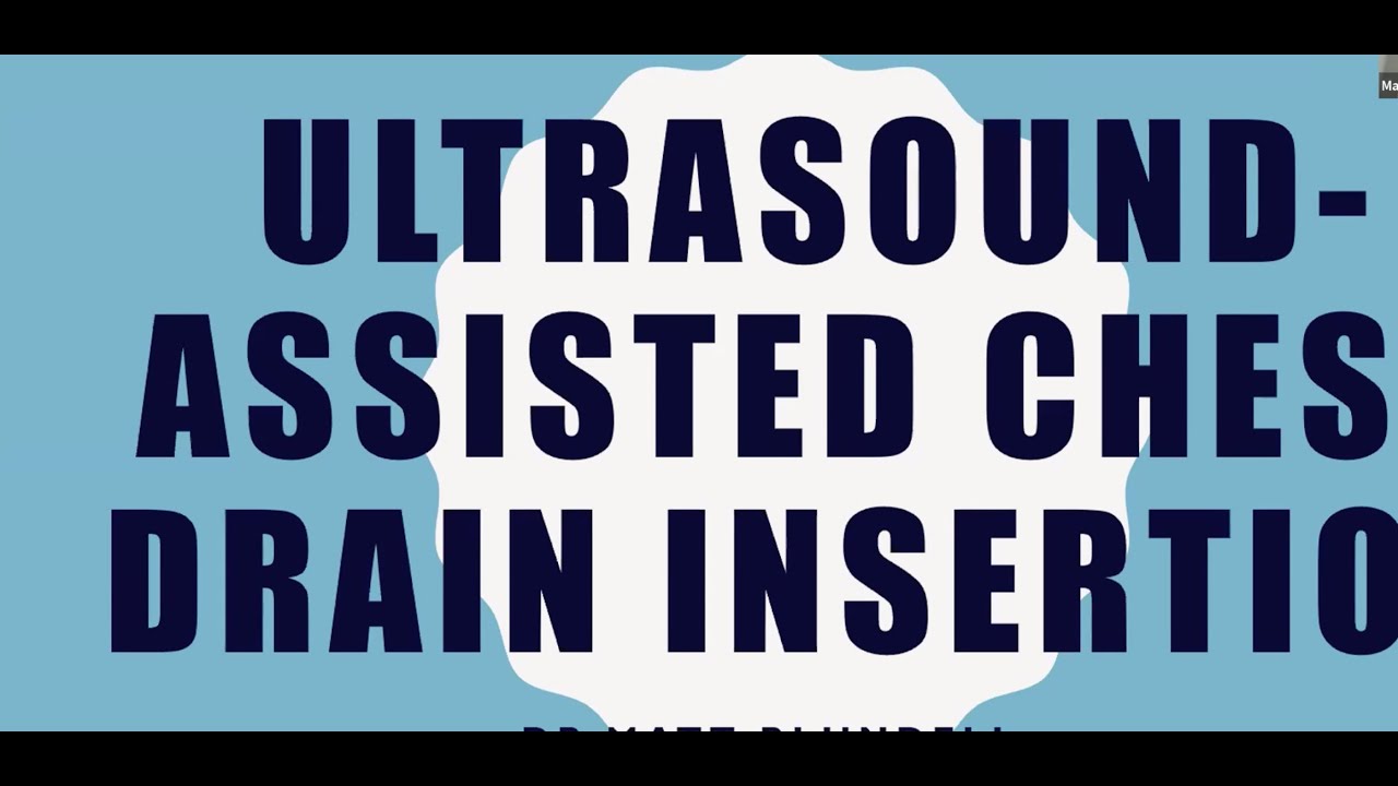 US-assisted Chest Drain Insertion
