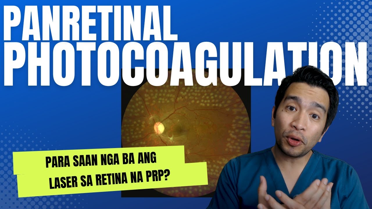 LASER SA MATA NA PANRETINAL PHOTOCOAGULATION (PRP) PARA SAN NGA BA ITO?