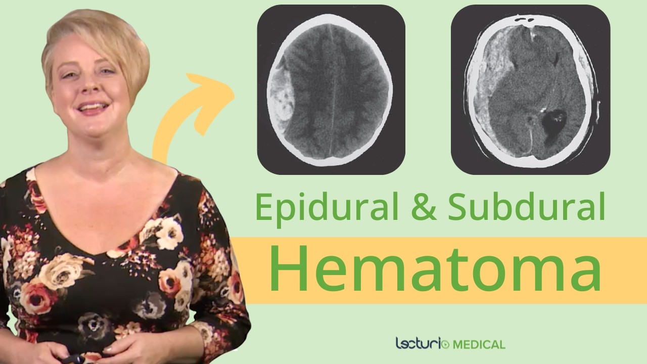 CT Imaging for Epidural Hematoma: What You Need to Know 🧠📊