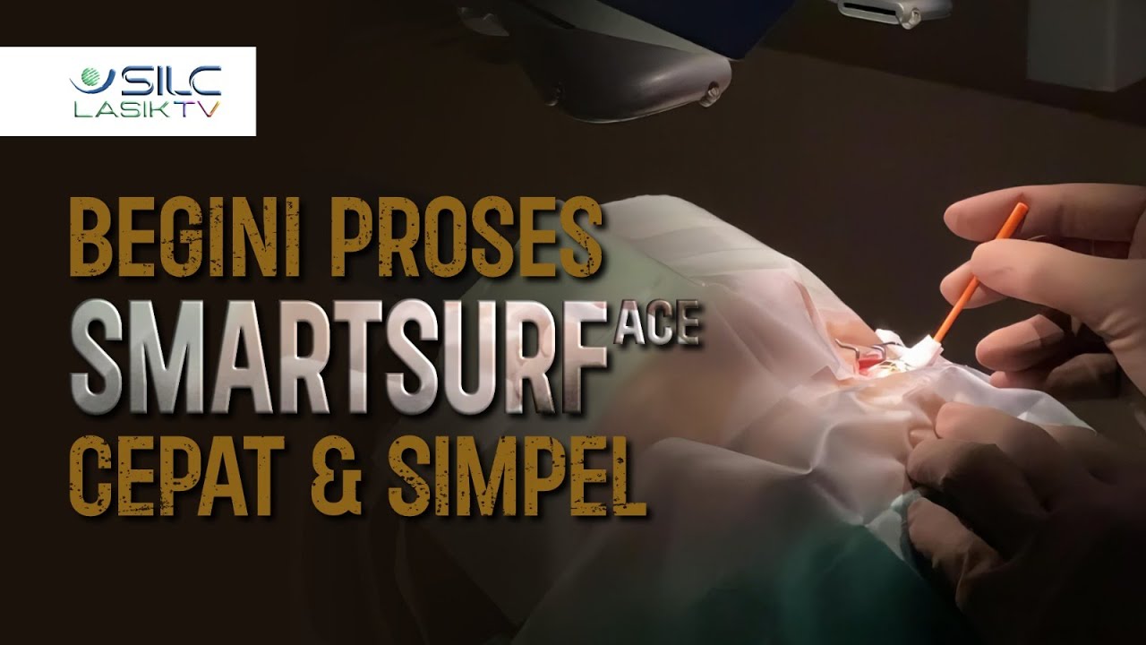 Begini Proses SmartSurface, Cepat dan Simpel