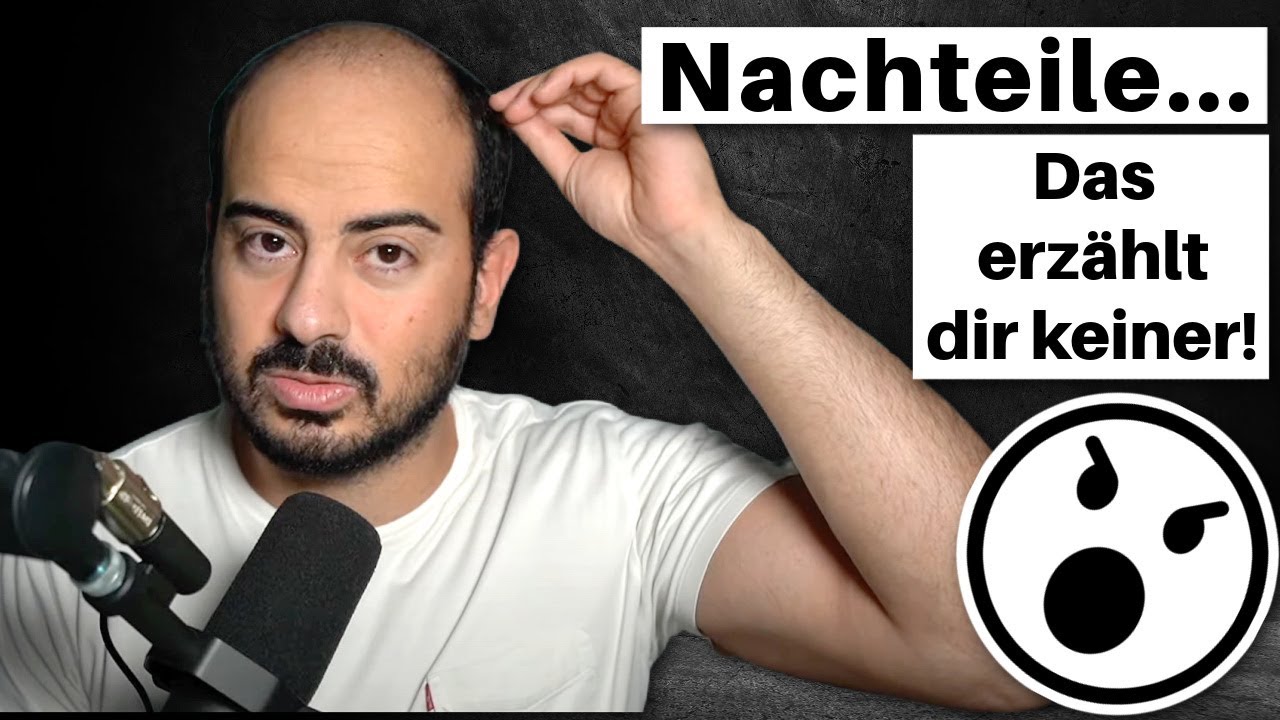 Das verschweigt dir jeder &uuml;ber das Haarteil...