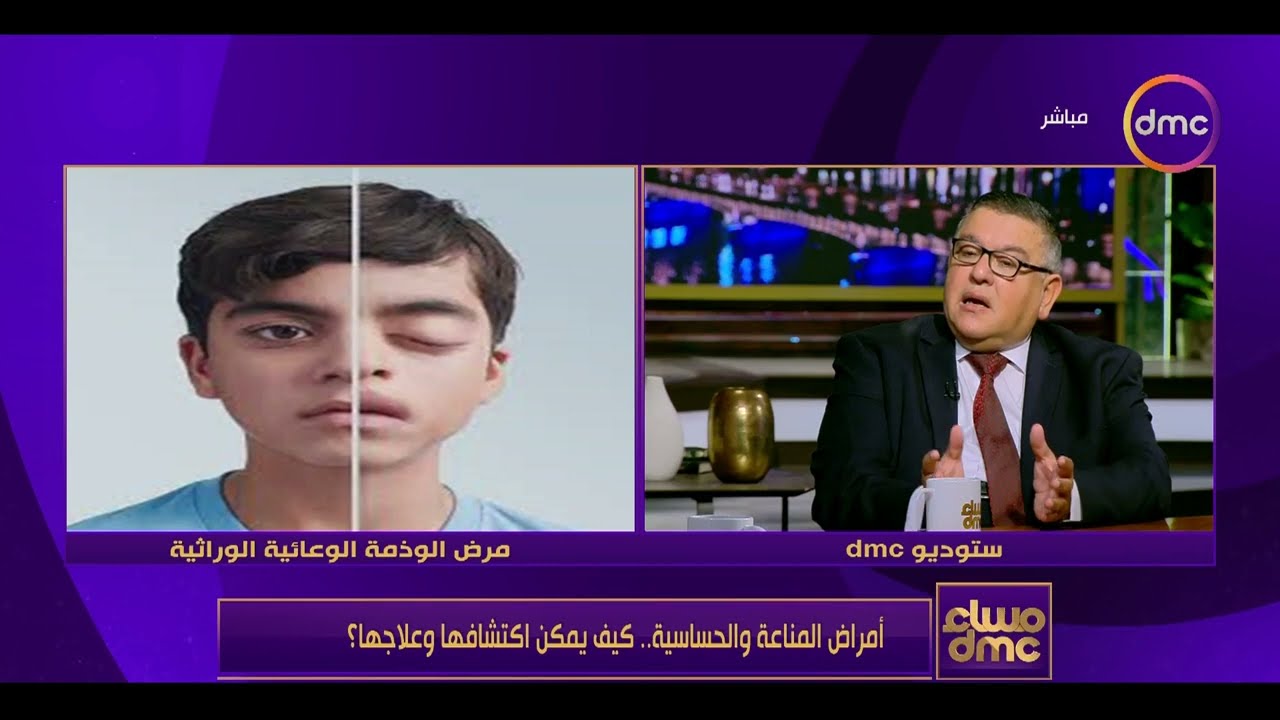 مساء dmc - أمراض المناعة والحساسية.. كيف يمكن اكتشافها وعلاجها؟