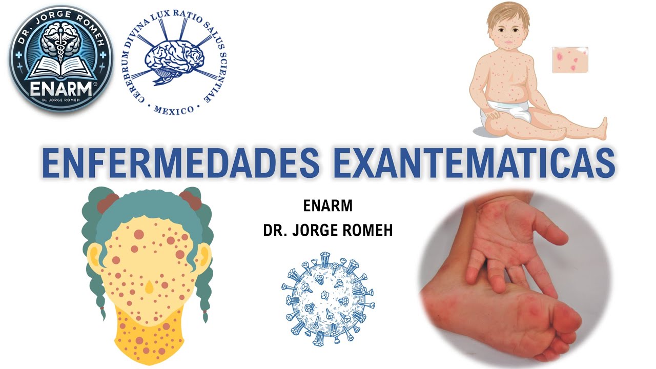 ENFERMEDADES EXANTEMATICAS - ENARM - TODO LO QUE DEBES SABER
