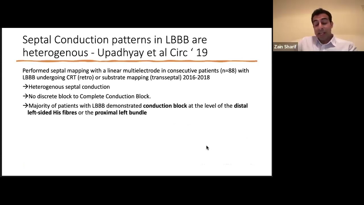 Left Bundle Branch pacing - Dr. Zain Sharif, MD, - SSA CRM