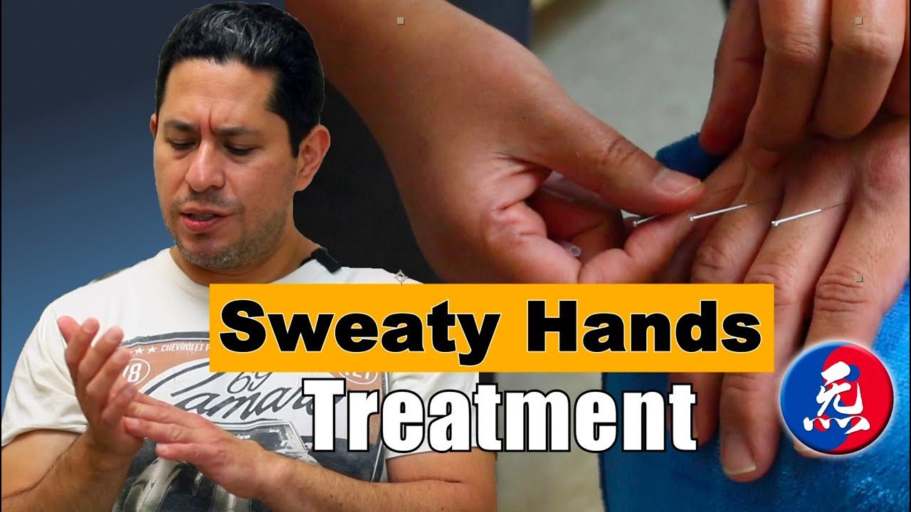 Acupuncture treatment for sweaty hands and back pain at the same time?
