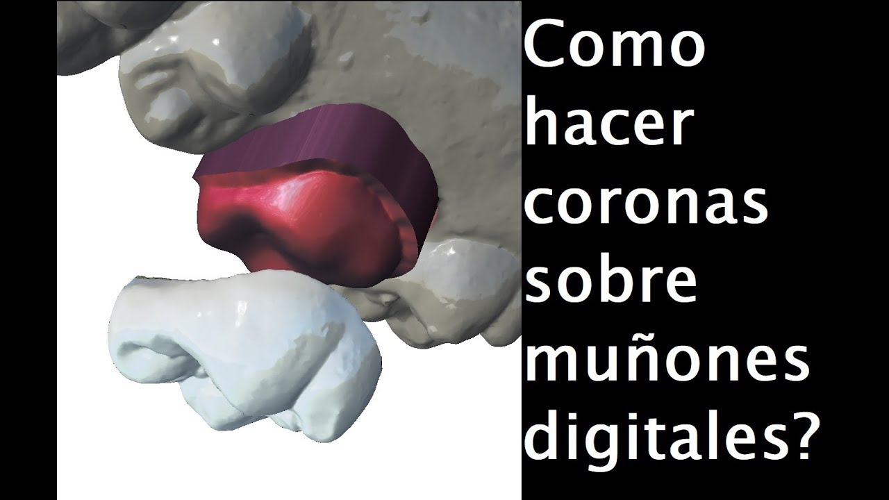 Como hacer coronas sobre muñones digitales en meshmixer Tutorial 14