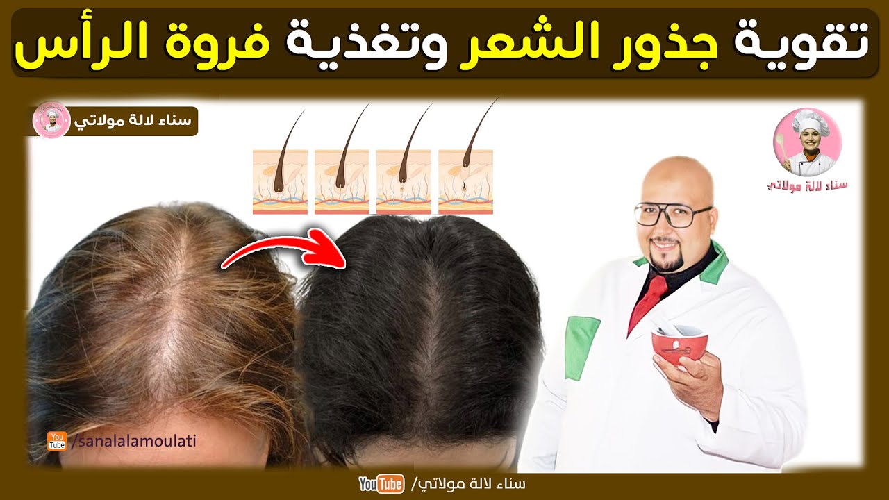 وصفات طبيعية لتقوية جذور الشعر وتغذية فروة الرأس | وصفات الدكتور عماد ميزاب Dr Imad Mizab