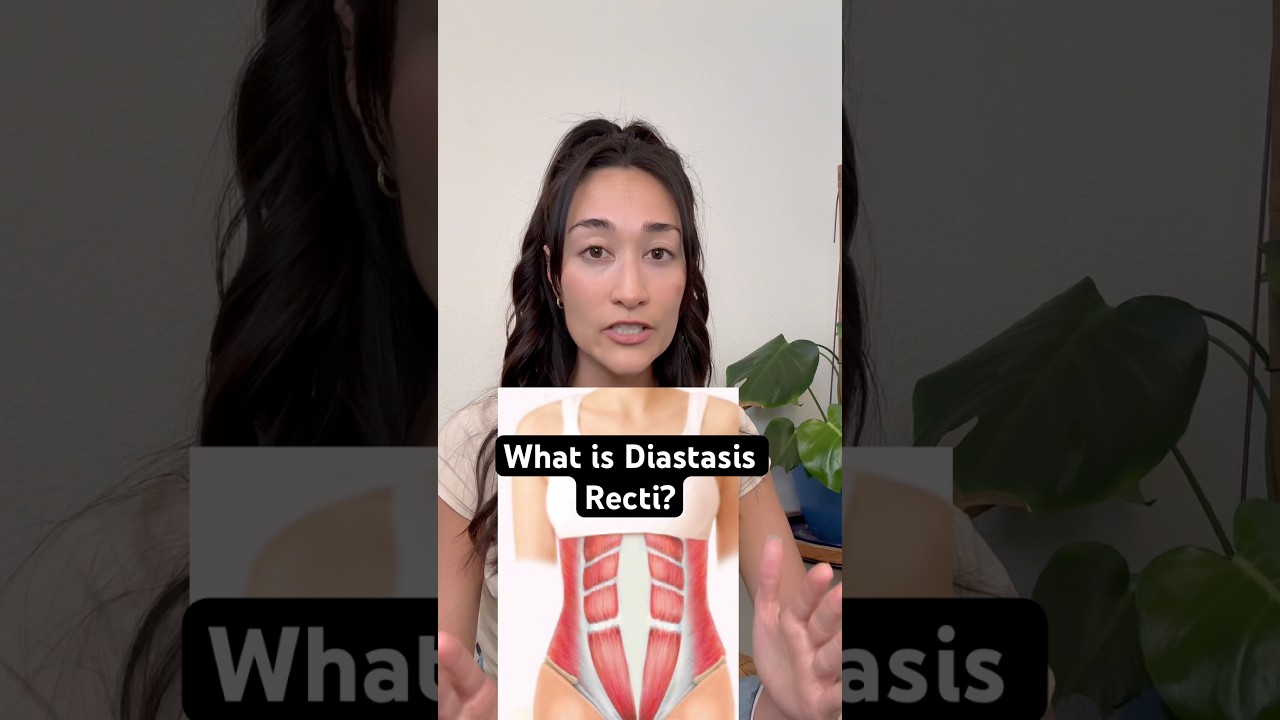 100% of pregnant people experience #DiastasisRecti by their 3rd trimester, this is NORMAL!