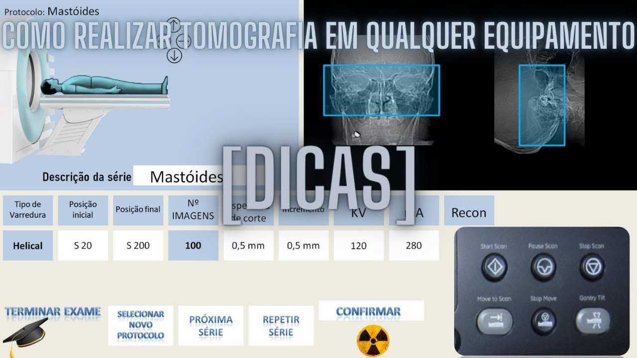 [DICAS] COMO REALIZAR TOMOGRAFIA EM QUALQUER EQUIPAMENTO