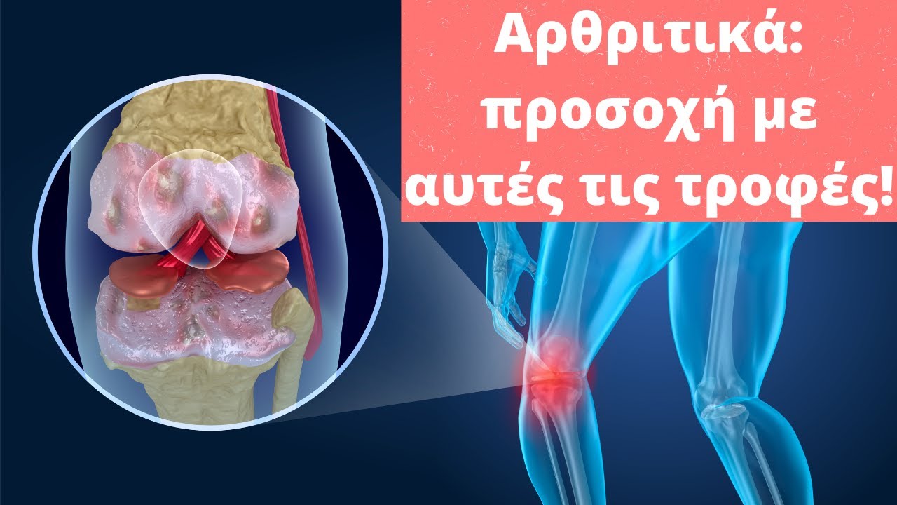Αρθριτικά: προσοχή με αυτές τις τροφές!
