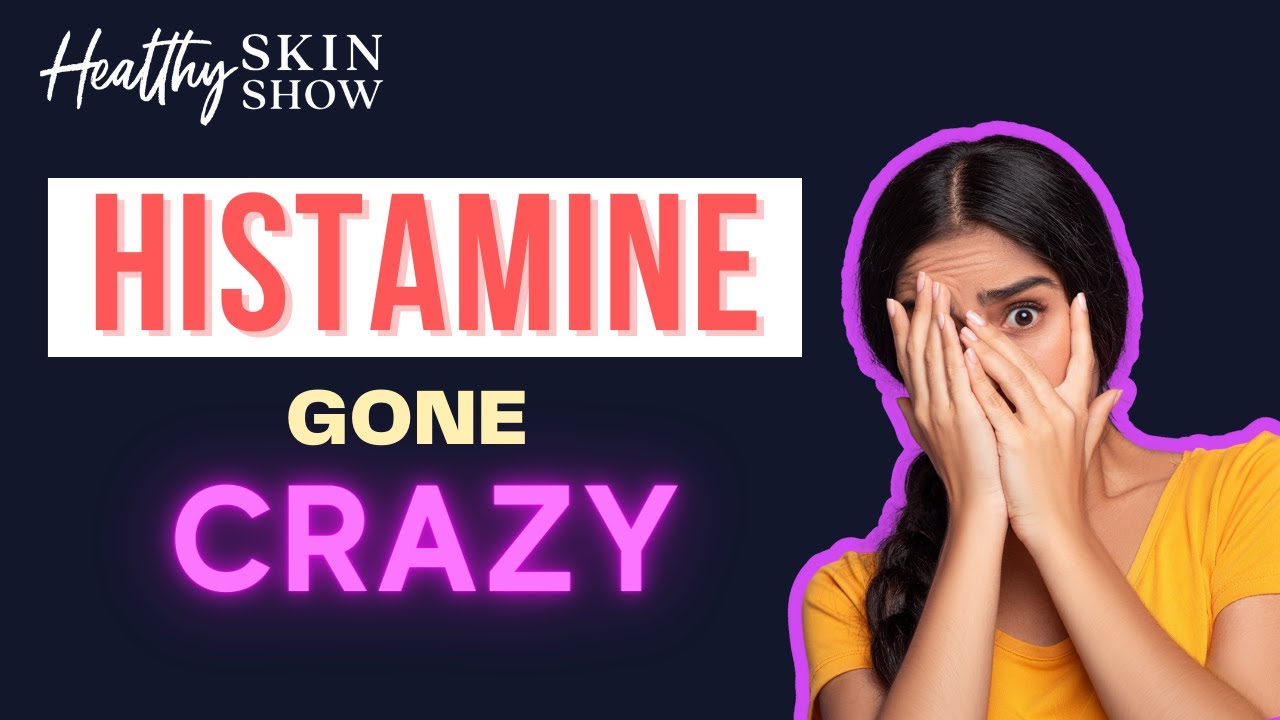MCAS Mast Cell Activation Syndrome Symptoms + Treatment (It's Histamine Hell) | Jill Carnahan