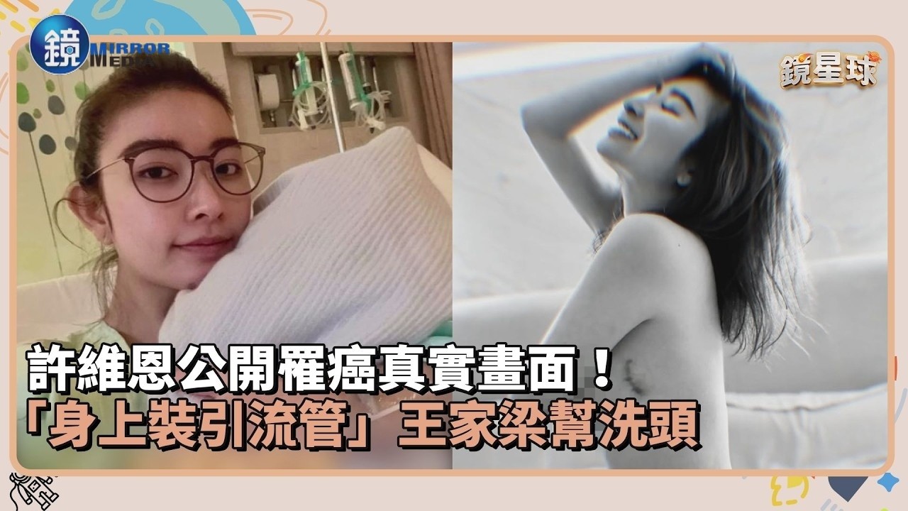 許維恩公開罹癌真實畫面！「身上裝引流管」王家梁幫洗頭｜鏡週刊Ｘ鏡新聞