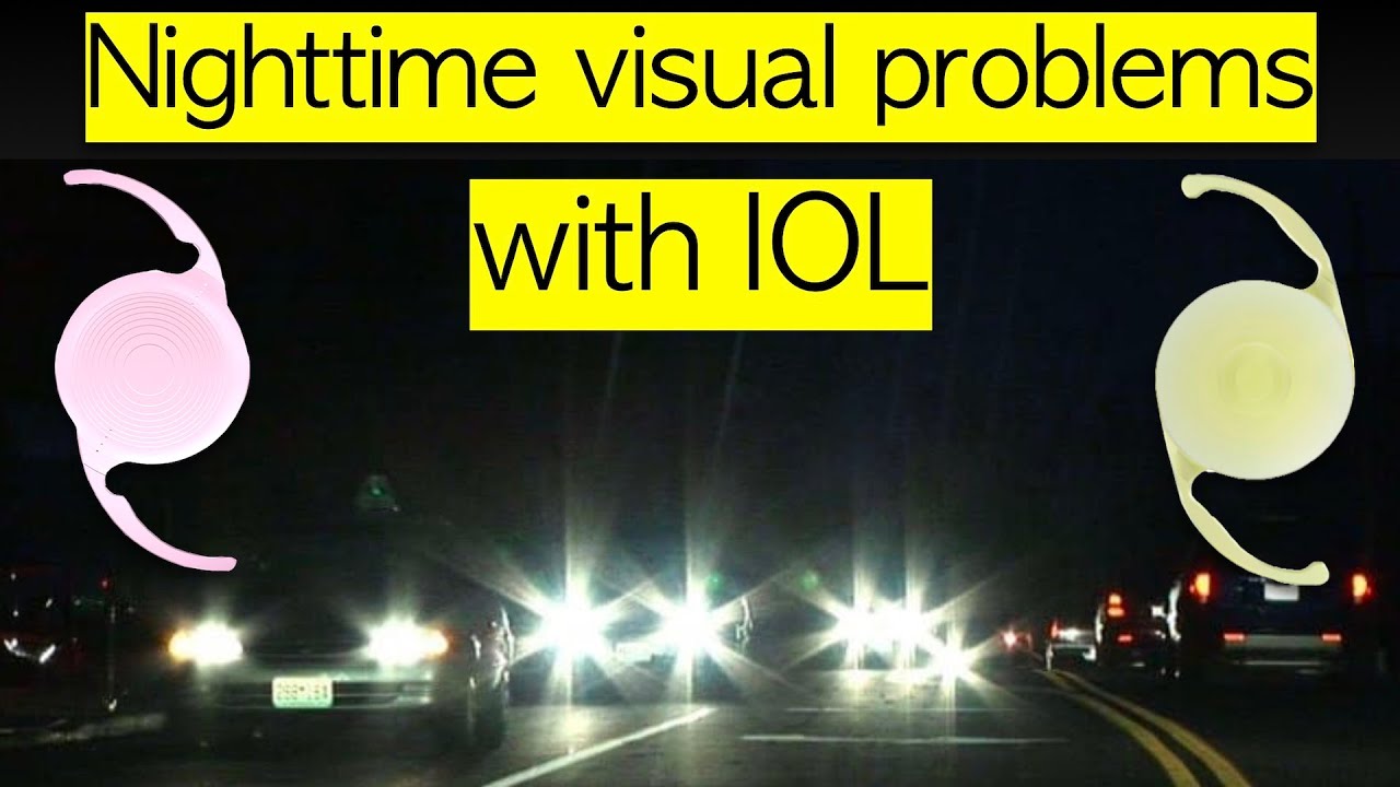 Nighttime vision problems after cataract: nighttime dysphotopsias
