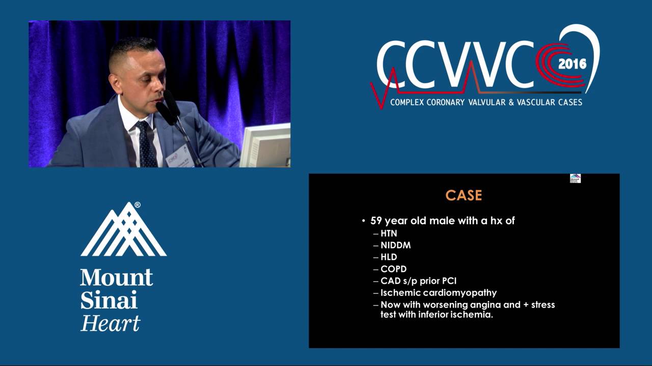 Chronic Total Occlusions: Current Techniques and Approaches