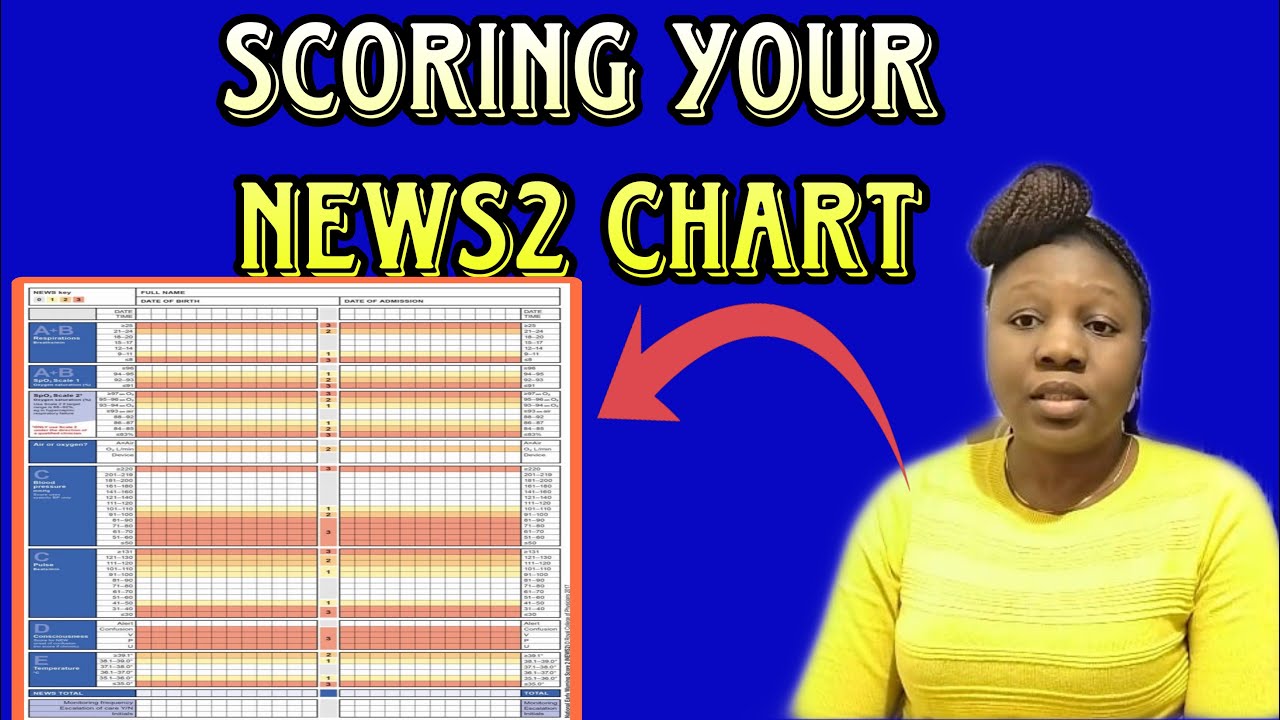 Get your NEWS Chart Right in Assessment station