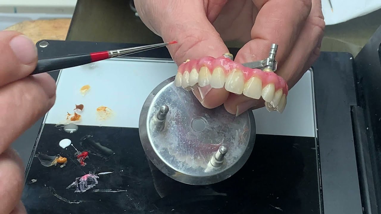 Toronto in composito / Parte 5: Lucidatura e rifinitura protesi in composito