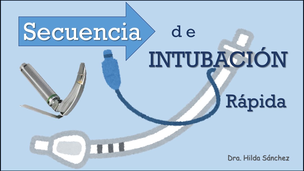 Secuencia de Intubación Rápida en Urgencias | Las 7 P’s explicadas paso a paso