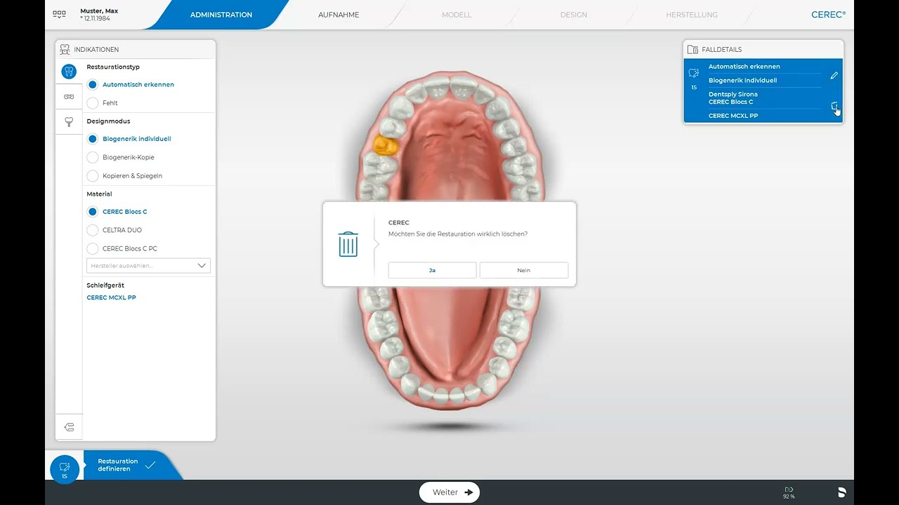 CEREC Software 5: Die Administrationsphase