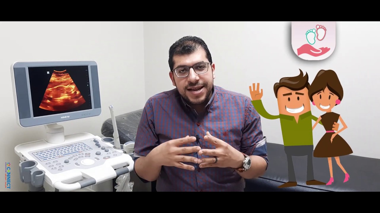 تحديد جنس المولود