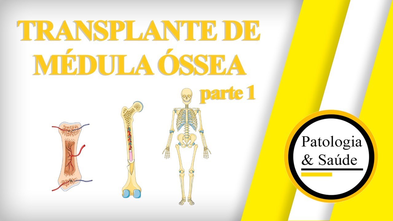 Transplante de medula óssea: como funciona?