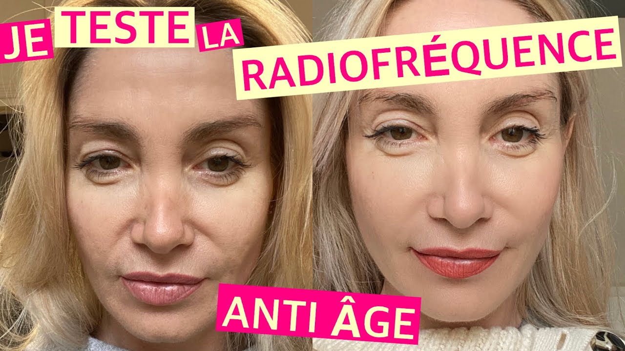 JE TESTE LA RADIOFRÉQUENCE ANTI ÂGE !