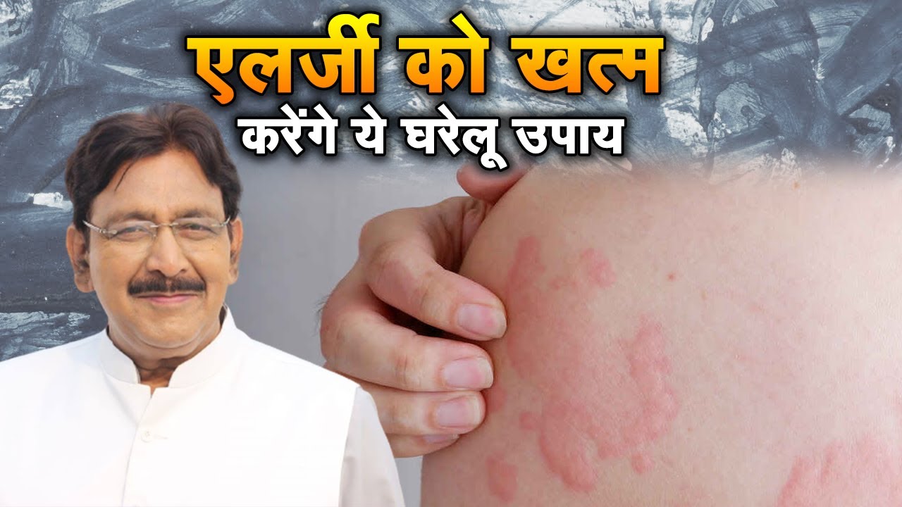 एलर्जी को खत्म करेंगे ये घरलु उपाय । Hakim Suleman Khan | Sadhna TV